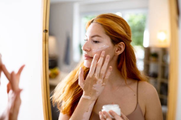 Skincare Routine for Acne-Prone Individuals